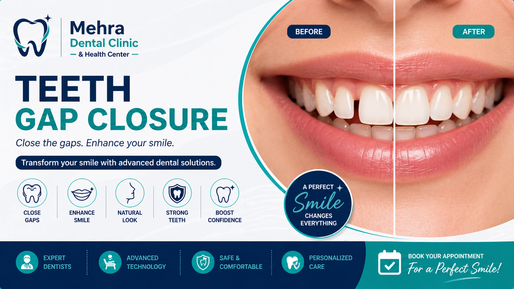 Teeth Gap Closure: Achieve a Perfectly Aligned Smile