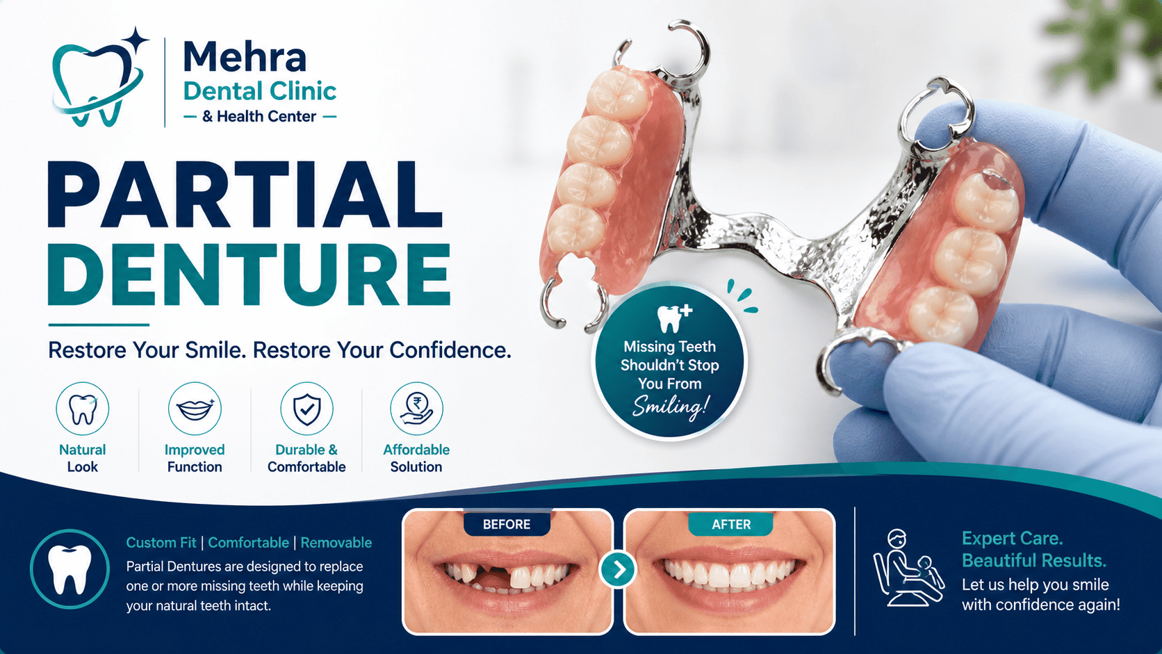 Partial Denture: Restore Your Smile with a Cost-Effective Solution